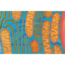 Мітохондріальна дисфункція